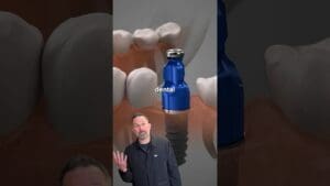 Should you get dental implants? What to know first from a cosmetic dentist