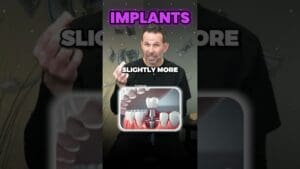 The Cost of Dental Implants?