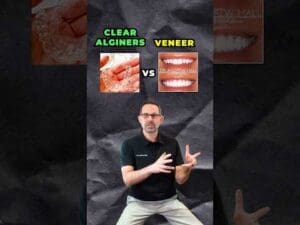 Clear Aligners Vs Veneers? Which is Better For You?