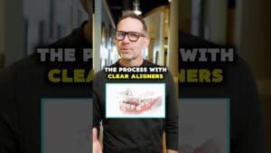 Removing Wisdom Teeth for Clear Aligners? | Cosmetic Dentist Explains
