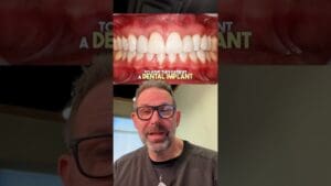 Can Dental Implants Save Your Smile? Cosmetic Dentists Dental Implant Review