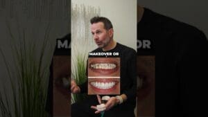Can I Get A Smile Makeover?
