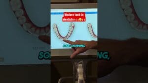 Dental technology for teeth before and after