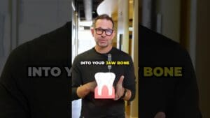 How Expensive Are Dental Implants?