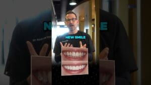 If you’re wanting to change the size & shape of your teeth this will be the process